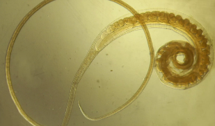 Trihozefalez whip worm